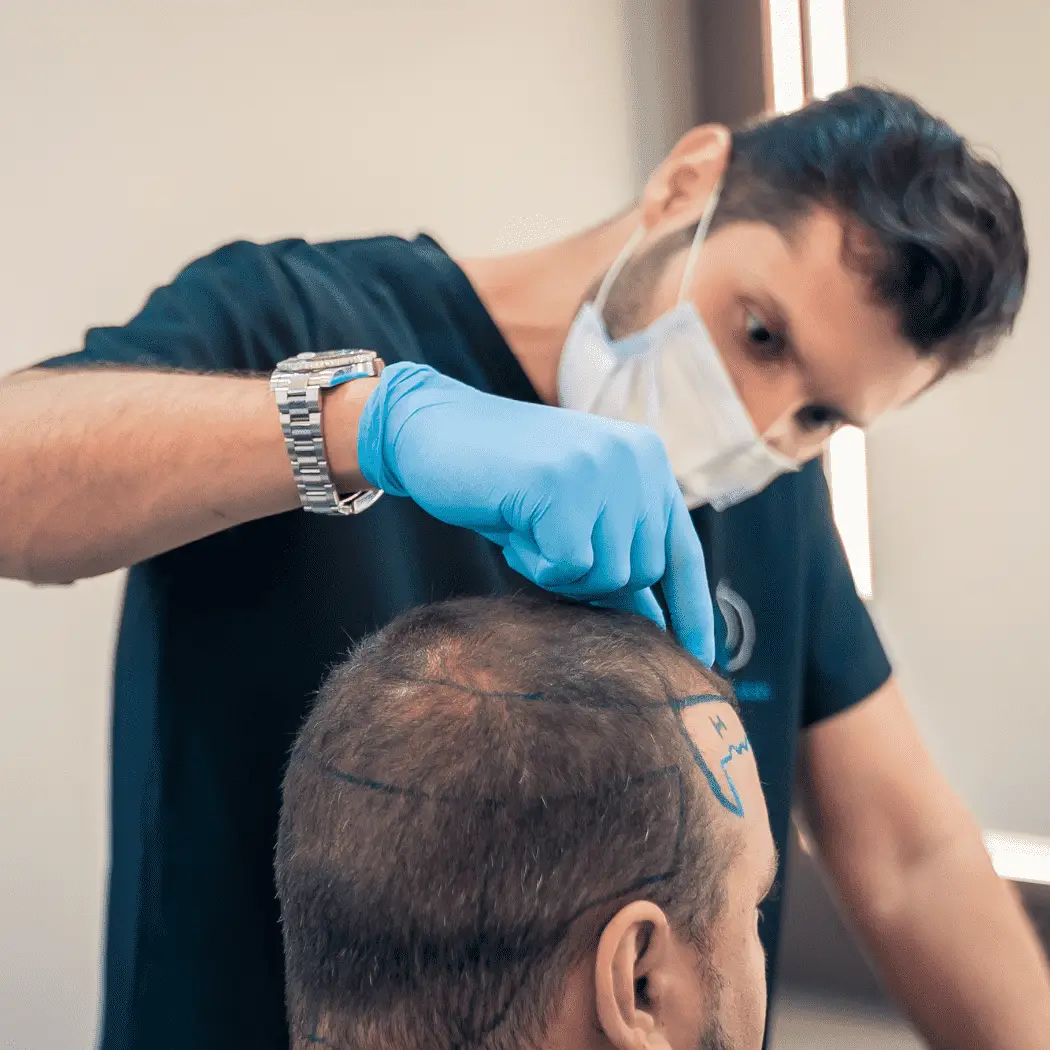 transplante_capilar_dr.fabricio_