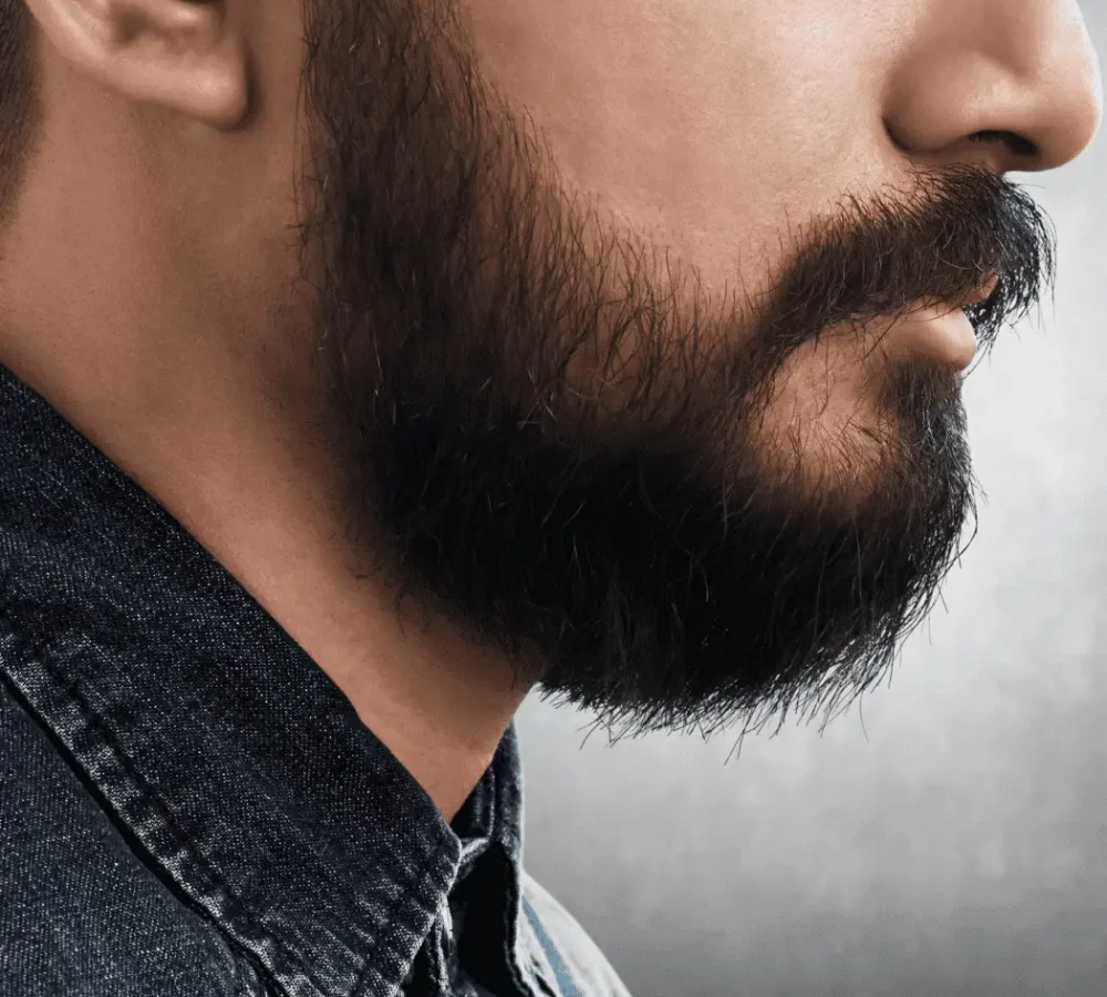 transplante_de_barba_dr.fabricio (1)
